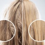 همه چیز درباره بوتاکس مو