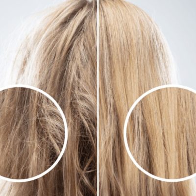 همه چیز درباره بوتاکس مو